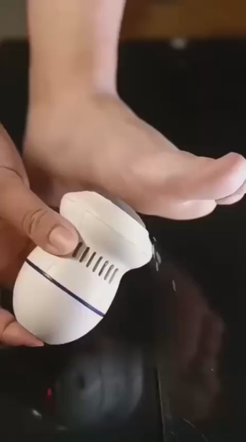 Auto Foot Callus Remover & Scrubber
